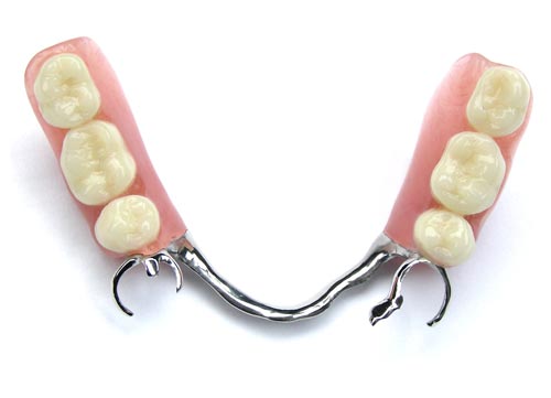 chrome removable partial dentures